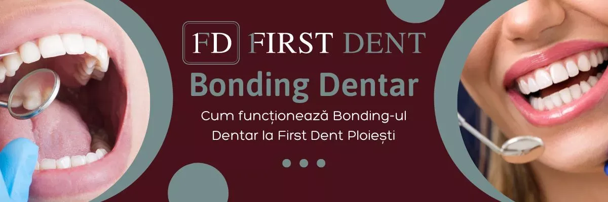 Cum Funcționează Bonding-ul Dentar la First Dent Ploiești