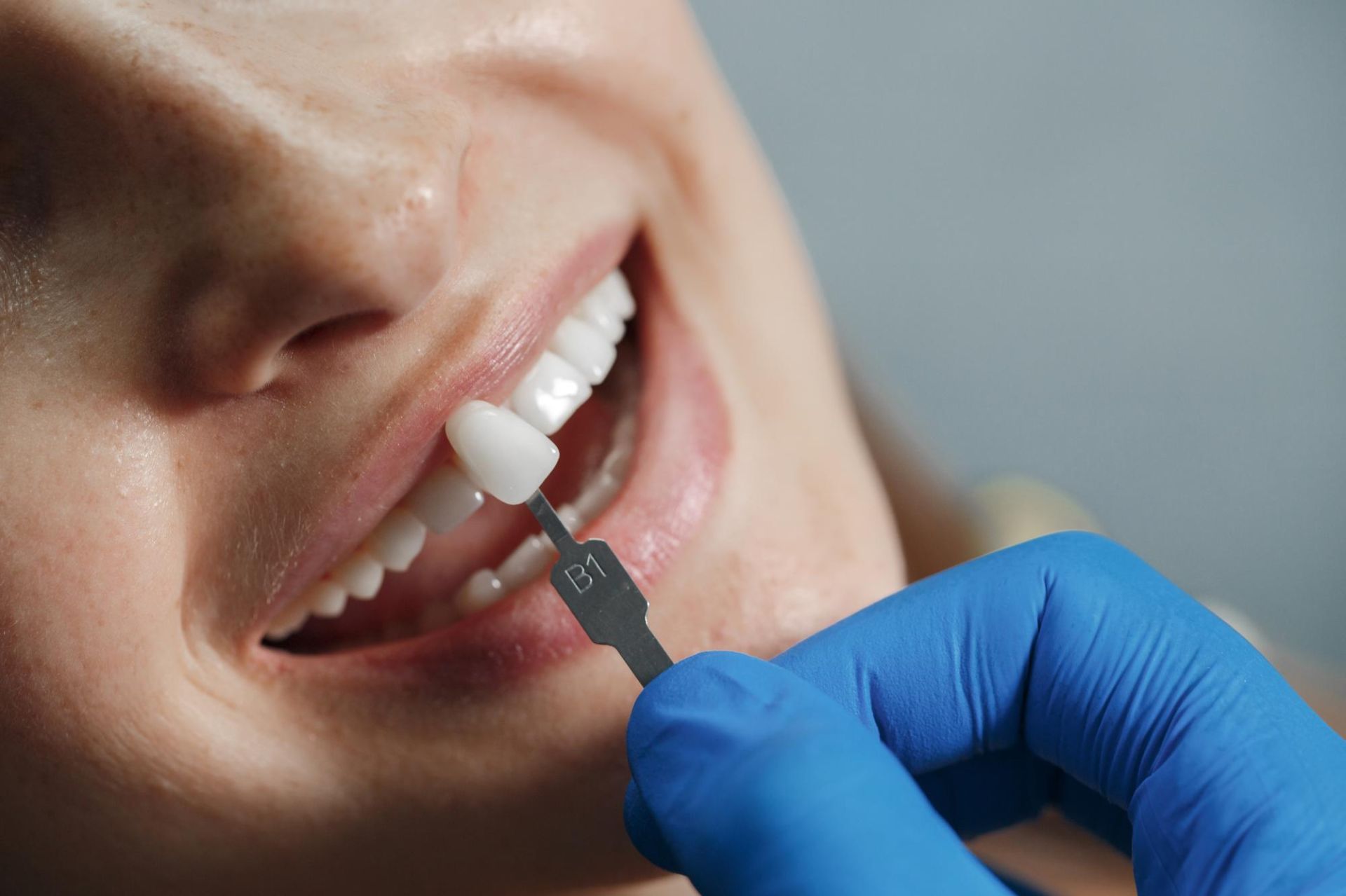 dentist-whiting-teeth.jpg